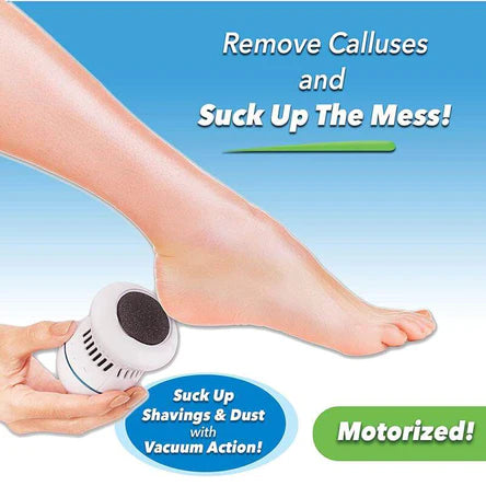 Electric Pedicure Foot File